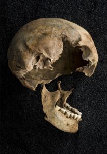 C0046299 Skeletons