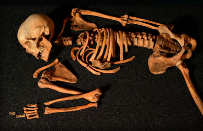 gaelic skeleton hunterian
